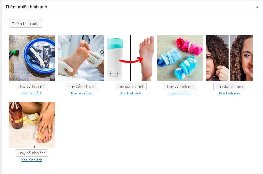 Kết quả tạo MetaBox đính nhiều hình ảnh trong WordPress